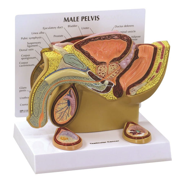 Male Pelvis Anatomy Model with Testicular Cancer